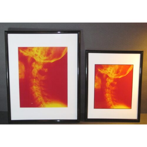Cervical X ray Chiropractic Framed Prints 11 X 14 Matted 