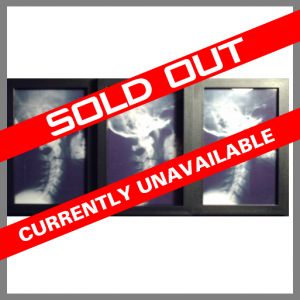 Chiropractic Art Cervical Spine X-ray Tri Window Frame Black and White Sold Out