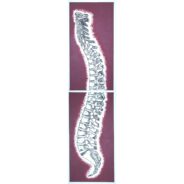 Double Canvas Chiropractic Art Spine