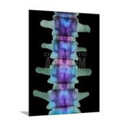 Chiropractic Art Colorful Lumbar Spine AP X-ray Poster Print